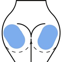 Martinni Baby Butt Sculpting Mask Photo